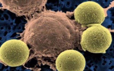 A startup trying to get the human body to fight cancer just filed for an IPO