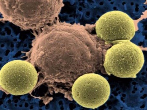 A startup trying to get the human body to fight cancer just filed for an IPO